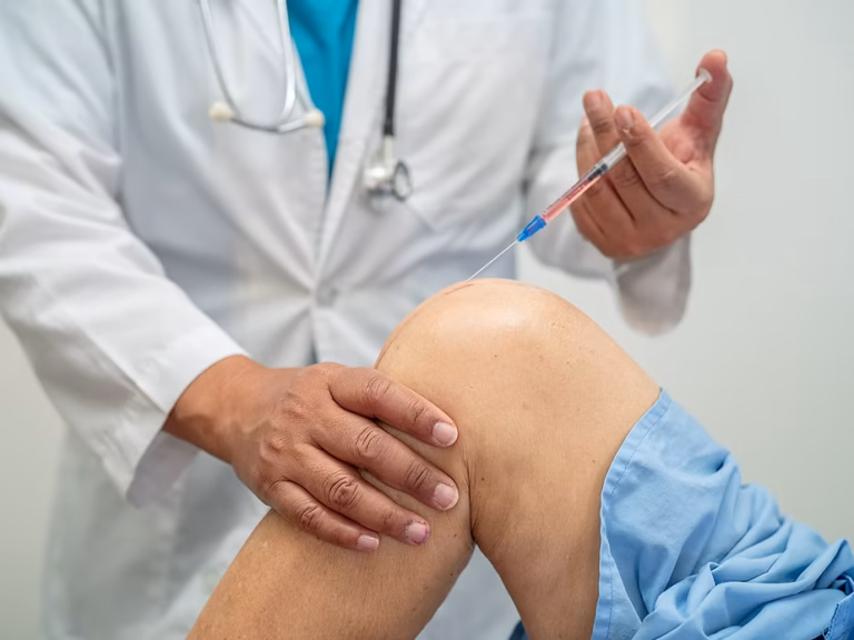 prolotherapy